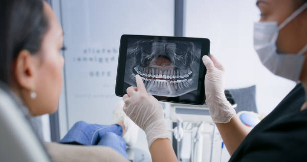 Licensed Tooth Extraction service in Richmond, KY - Smile Center Dentistry